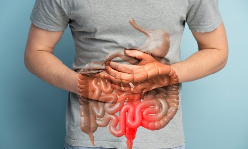 Homeopathy for Gastrointestinal
